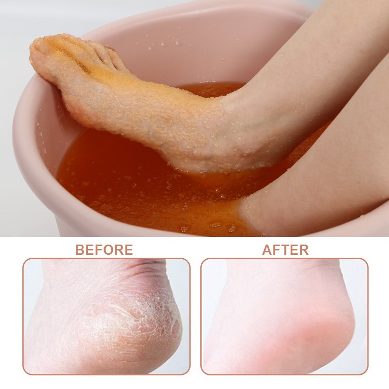 Crystaljelly Pedicure Hot Mask - 5